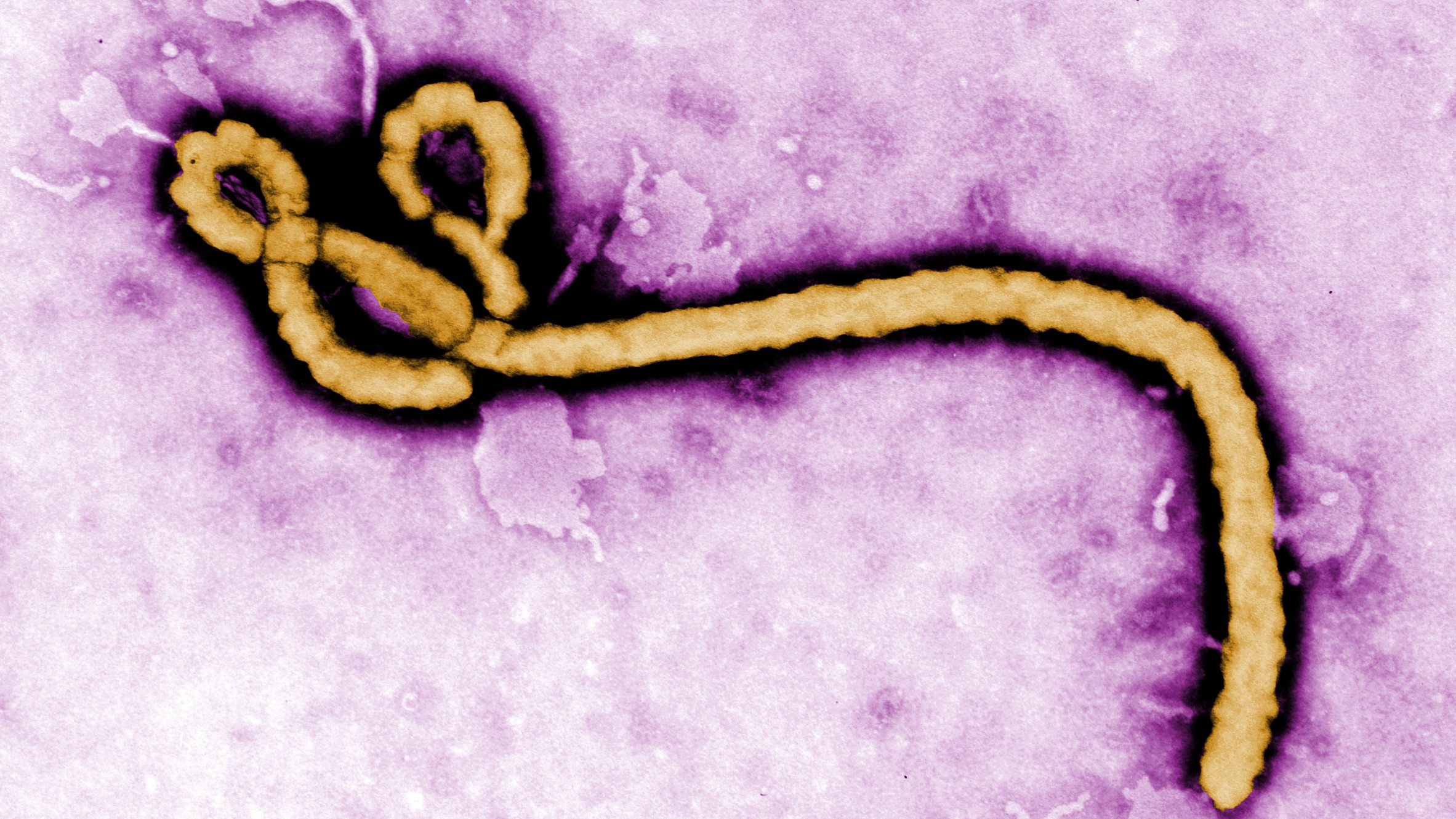Ebola Virus Microscopic image of the Ebola virus