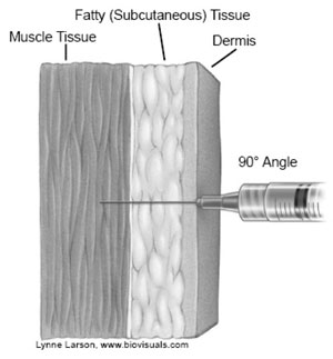vaccine figure 4 Illustration of injection through dermis and fatty tissue into muscle tissue at 90-degree angle.